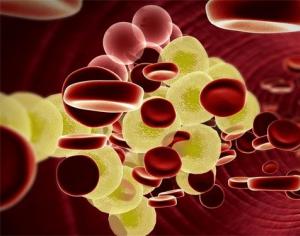 Как лечить повышенный уровень холестерина в крови